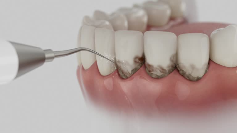 Trusted Dental Crowns And Bridges service in Hillsboro, KS - Dentist Open Now